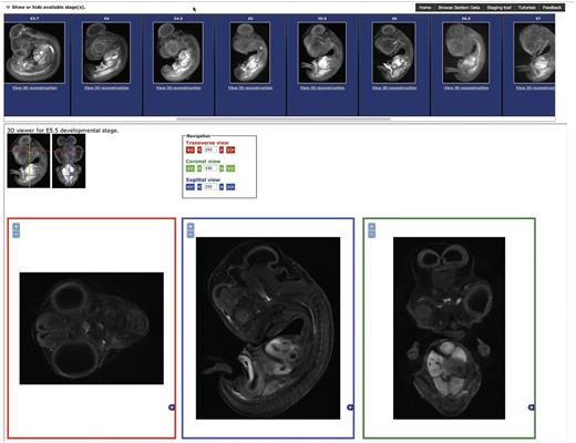 The Section Browsing Tool. The stage of interest can be selected by clocking on the rendered images in the top panel. Once a stage has been selected, the three section views, transverse, sagittal and coronal will be displayed. The displayed section can be updated by clicking on the 3D rendered images and the image size adjusted using the plus and minus buttons in each window.