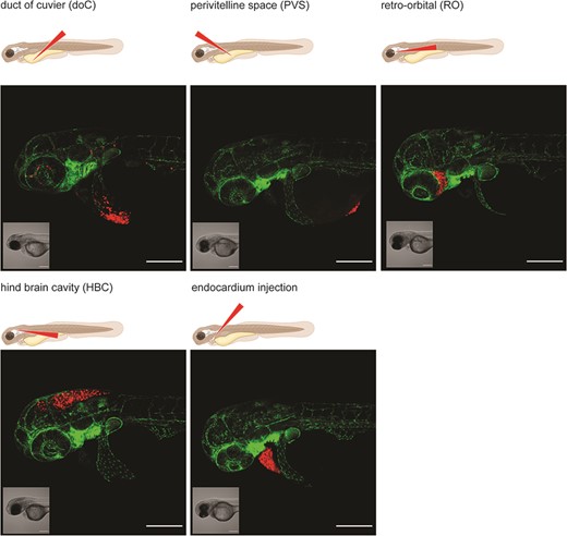 Graphical representation of common injection sites of the zebrafish xenograft model. Injection through the duct of Cuvier, a common route of injection to generate hematogenously disseminated cancer, is also described as an experimental micrometastatic model (10, 11). Perivitelline space injection, originally described as a model for the generation and assessment of angiogenesis, more recently developed as a model for the generation of primary-like tumors (6). Retro-orbital engraftment, used for the generation of orthotopic primary-like tumors derived from eye tumors, allows for the development of distant metastases (12). Hindbrain cavity injection models are used for the generation of orthotopic brain cancer models and for the generation of brain metastasis models (13). Intra-pericardial injection, used for the establishment of primary-like tumors, in an environment closed off from further blood circulation (14, 15). All larvae were injected with ∼200–300, tdTomato expressing cancer cells at 48hpf and imaged at approximately 2 h post-injection using a Zeiss LSM800 laser scanning confocal microscope with an Airyscan detector.