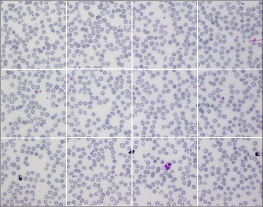 Samples images from AneRBC-II dataset, where 1224 × 960 is divided into 12 subimages with size 306 × 320.