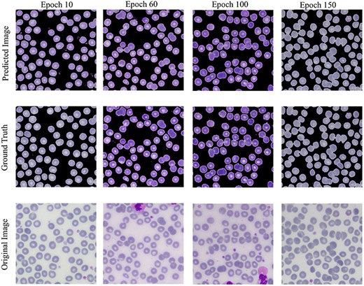 Visual results of image segmentation using the GAN network at different epochs.