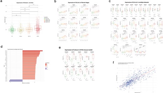Multilevel assessment of COL1A1 expression and coexpression in MASH-GA. COL1A1 expression increases from normal controls to obese and NAFLD groups and is highest in NASH. Across independent datasets, COL1A1 rises with fibrosis stage and is consistently upregulated in NASH relative to earlier stages. Coexpression and gene-pair analyses show coordinated extracellular matrix-related expression, including strong association with COL1A2, and similar induction is observed in HFHS mouse models.