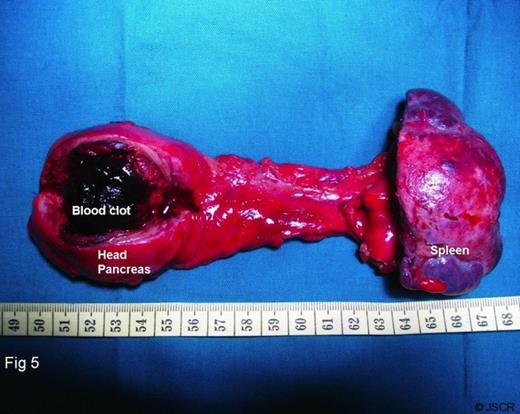 Photograph of resected specimen