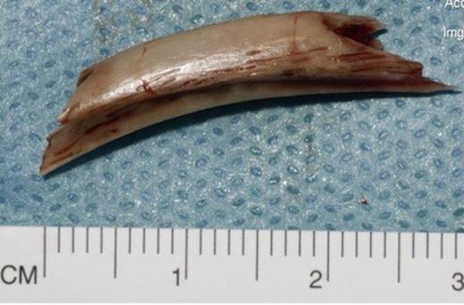 Fragment of pig bone