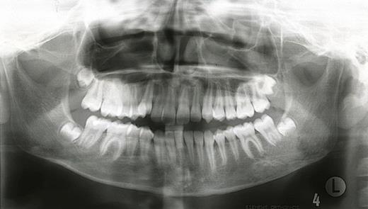 Orthopantomogram in 2004