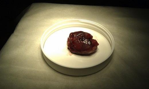 Macroscopic excised leiomyoma specimen (5 x 3.5 x 3 cms).