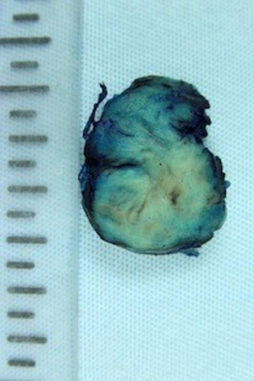 Cut surface of specimen demonstrating whorled surface.