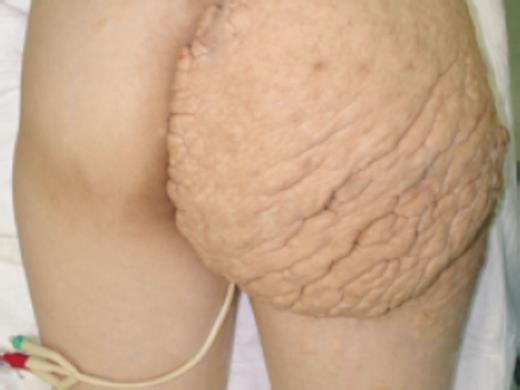 Appearance of the patient on presentation