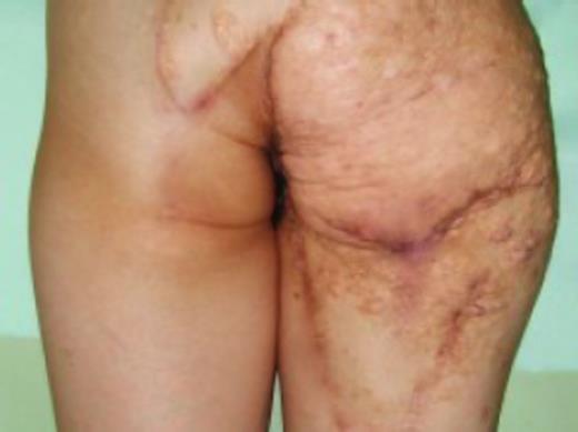 Appearance of the patient at 2-year follow-up