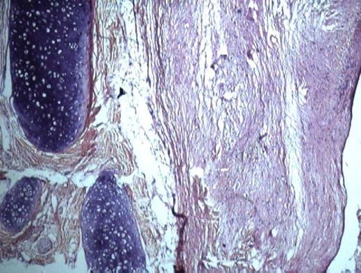 Histological specimen