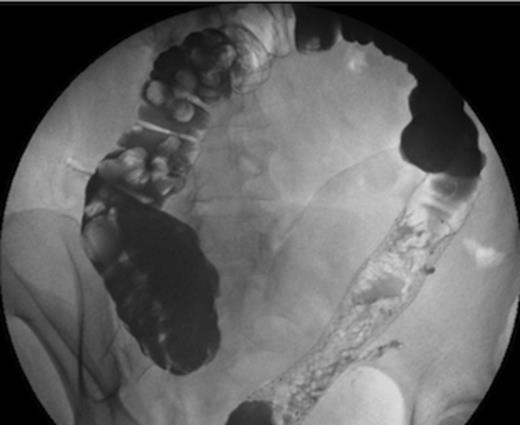 Follow-up contrast study