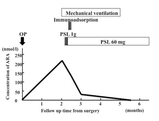A chart showing the clinical course.