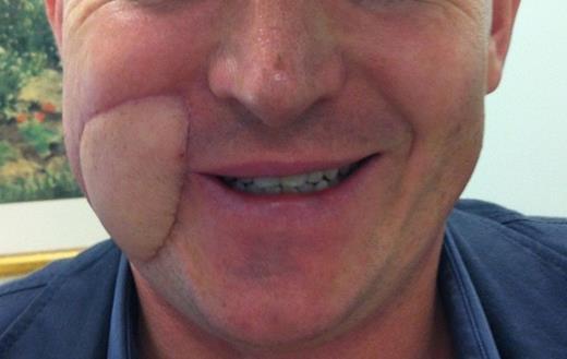 Post-operative appearance