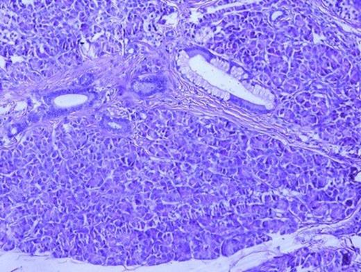 Photomicrograph showing pancreatic acini and ducts (H&E, x100)