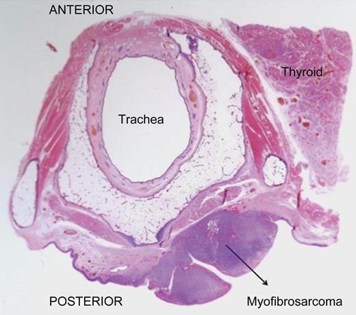 Scanning magnification.
