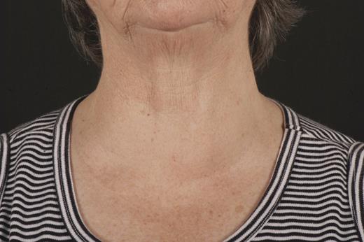 Patient photograph anterior view.