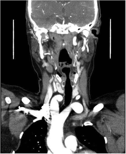 Imaging coronal section.