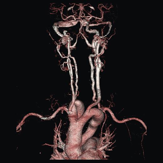 Imaging 3D reconstruction, anterior view.
