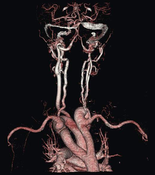 Imaging 3D reconstruction, posterior view.