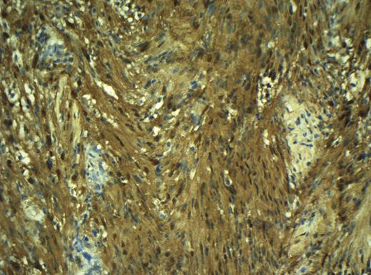 Histopathological image.