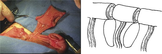 Segment of the jejunal loop.