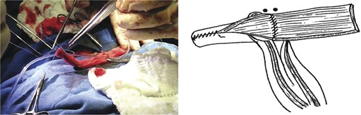 Transverse retubularization.