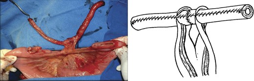 View of the final tube.