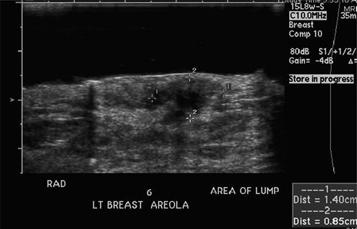 Ultrasound from January 2012.