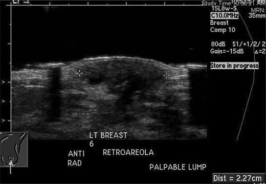 Ultrasound from April 2012.