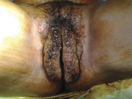 A pre-operative picture.