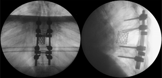 Postoperative radiographic appearance.