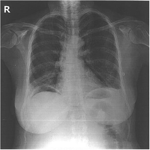 Postoperative X-ray.