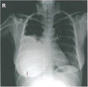 featured image