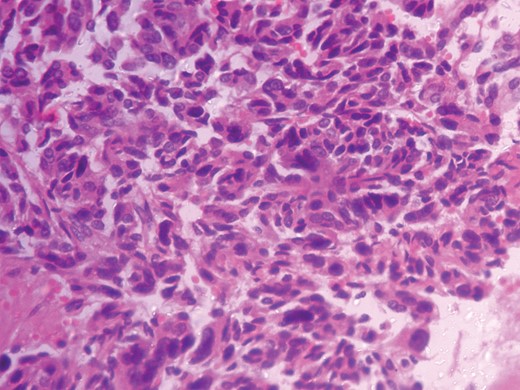 Histopathologic photograph-Low magnification.