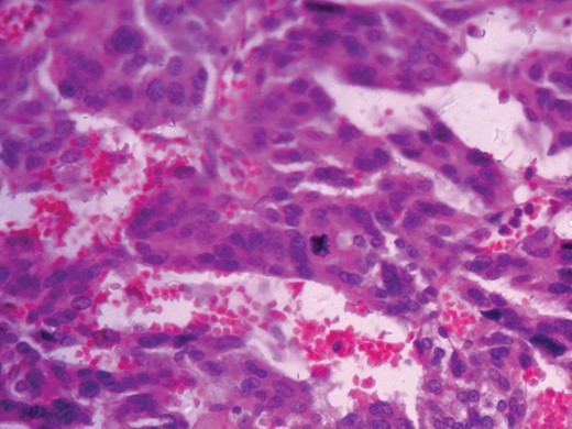 Histopathologic picture 40×.