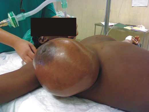 Tumor presentation before surgery.