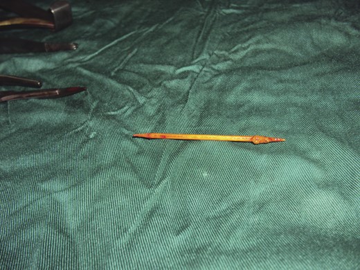 The wooden toothpick immediately after removal.