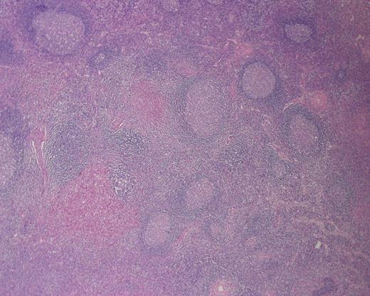 Photomicrograph of H&E-stained sections (Ă—200) showing microabscess formation.