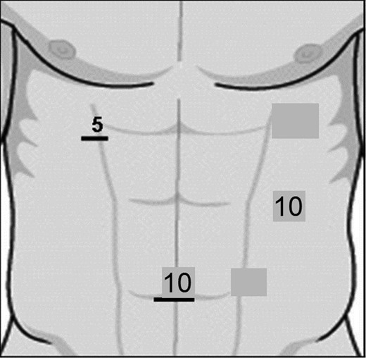 An illustration demonstrating the port sites.