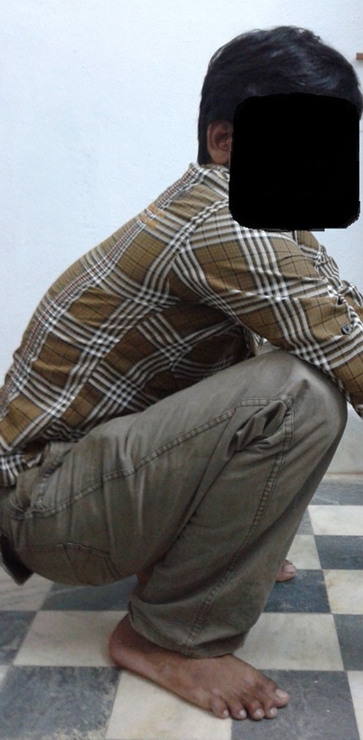 Clinical photograph at 7-year follow-up (squatting).