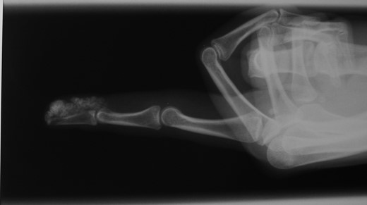 X-ray pre-op.