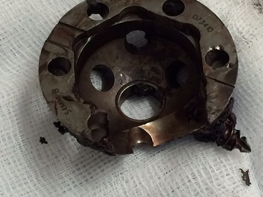 The acetabular component showing extreme wear-through and metallic fragments.