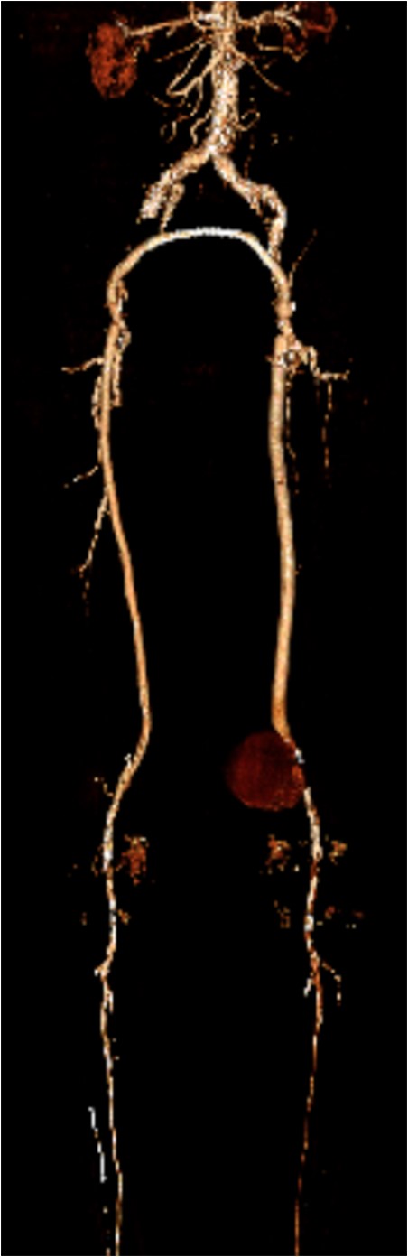 Three-dimensional reconstruction image of PS.