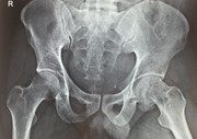 featured image