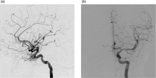 (a) and (b) Evidence of a CCF.