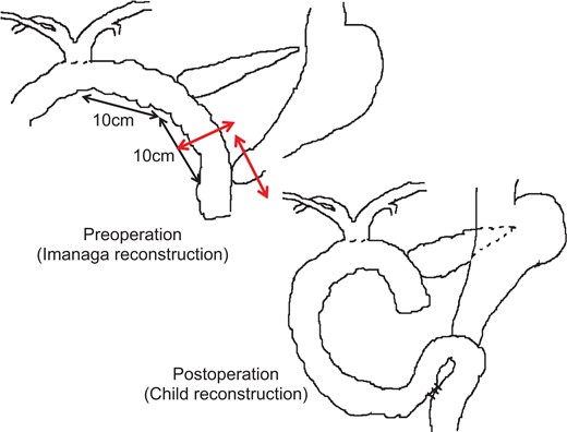 Operation schema.