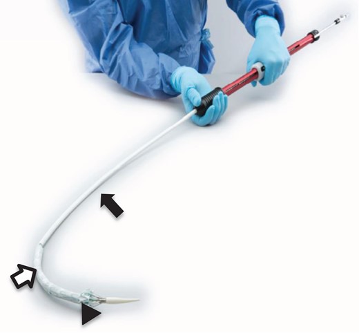 The Relay Plus® delivery system. The stent graft (black triangle) is compressed in the inner flexible sheath (white arrow), and also incorporated into the outer sheath (black arrow).