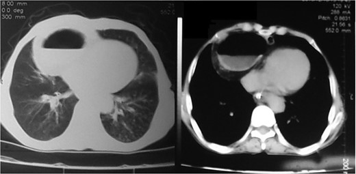 Preoperative axial CT images.