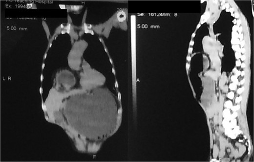 Preoperative coronal/sagittal CT images.