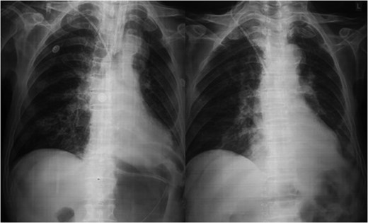 Postoperative X-ray.