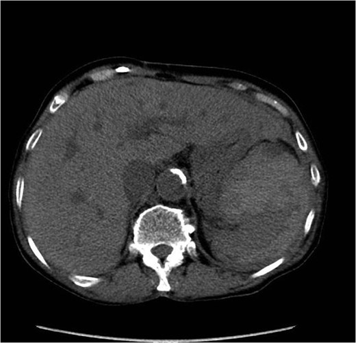 Axial image from CT with IV contrast.